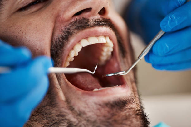 Best Emergency Dental Filling Replacement  in Monroeville, IN